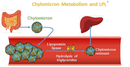 Familial Chylomicronemia Syndrome | About FCS